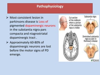 Pathophysiology
 Most consistent lesion in
parkinsons disease is Loss of
pigmented dopaminergic neurons
in the substantia nigra pars
compacta and niagrostriatal
dopaminergic tract .
 Approximately 60-80% of
dopaminergic neurons are lost
before the motor signs of PD
emerge.
 
