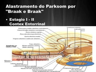 Alastramento do Parksom por 
"Braak e Braak" 
• Estagio I - II 
Contex Entorrinal 
 