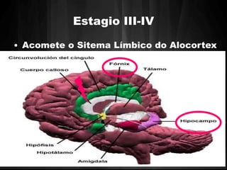 Estagio III-IV 
• Acomete o Sitema Límbico do Alocortex 
 