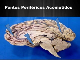 Pontos Periféricos Acometidos 
 