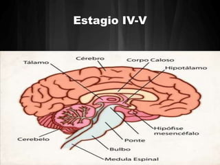 Estagio IV-V 
 