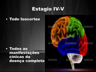 Estagio IV-V 
• Todo Isocortex 
• Todos as 
manifestações 
cínicas da 
doença completa 
 