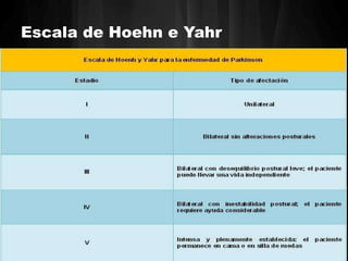 Escala de Hoehn e Yahr 
 