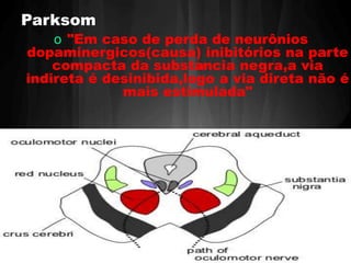 Parksom 
o "Em caso de perda de neurônios 
dopaminergicos(causa) inibitórios na parte 
compacta da substancia negra,a via 
de 
indireta é desinibida,logo a via direta não é 
mais estimulada" 
 