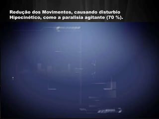 Redução dos Movimentos, causando disturbio 
Hipocinético, como a paralisia agitante (70 %). 
 