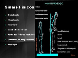 Sinais Físicos 
o Bradcinesia 
o Hipocinesia 
o Hiponimia 
o Marcha Parksoniana 
o Perda dos reflexos posturais 
o Fenomeno do congelamento 
o Hesitação 
 