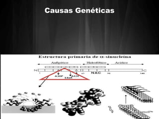 Causas Genéticas 
 