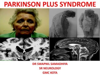 PARKINSON PLUS SYNDROME
DR SWAPNIL SAMADHIYA
SR NEUROLOGY
GMC KOTA
 