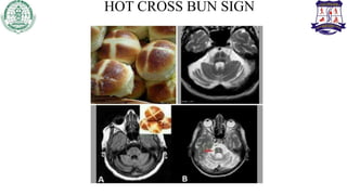 HOT CROSS BUN SIGN
 