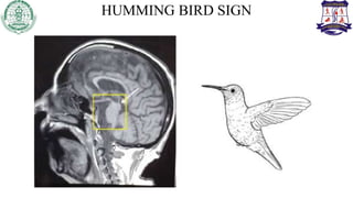 HUMMING BIRD SIGN
 