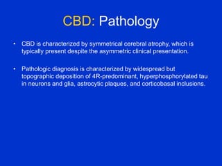 CBD: Pathology
• CBD is characterized by symmetrical cerebral atrophy, which is
typically present despite the asymmetric clinical presentation.
• Pathologic diagnosis is characterized by widespread but
topographic deposition of 4R-predominant, hyperphosphorylated tau
in neurons and glia, astrocytic plaques, and corticobasal inclusions.
 