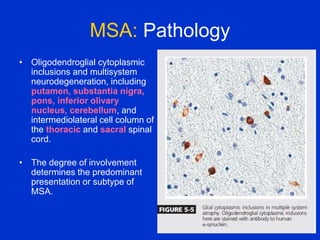 MSA: Pathology
• Oligodendroglial cytoplasmic
inclusions and multisystem
neurodegeneration, including
putamen, substantia nigra,
pons, inferior olivary
nucleus, cerebellum, and
intermediolateral cell column of
the thoracic and sacral spinal
cord.
• The degree of involvement
determines the predominant
presentation or subtype of
MSA.
 