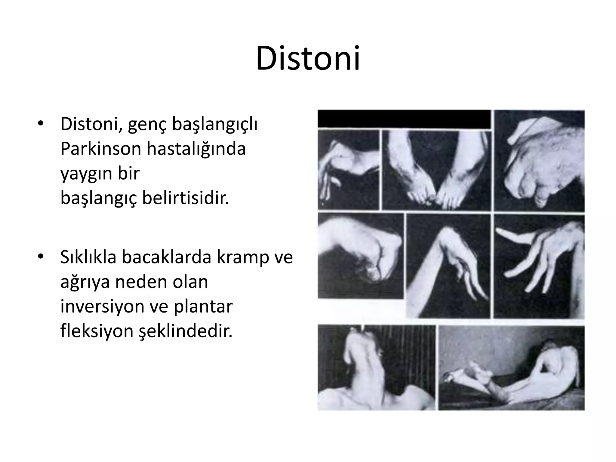 Parkinson rehabilitasyonu | PPTX