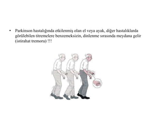 • Parkinson hastalığında etkilenmiş olan el veya ayak, diğer hastalıklarda
görülebilen titremelere benzemeksizin, dinlenme sırasında meydana gelir
(istirahat tremoru) !!!
 