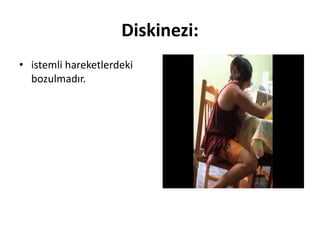 Diskinezi:
• istemli hareketlerdeki
bozulmadır.
 