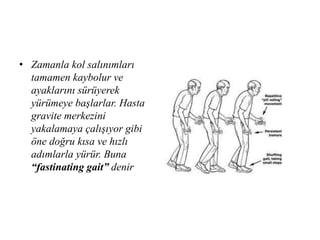 • Zamanla kol salınımları
tamamen kaybolur ve
ayaklarını sürüyerek
yürümeye başlarlar. Hasta
gravite merkezini
yakalamaya çalışıyor gibi
öne doğru kısa ve hızlı
adımlarla yürür. Buna
“fastinating gait” denir
 