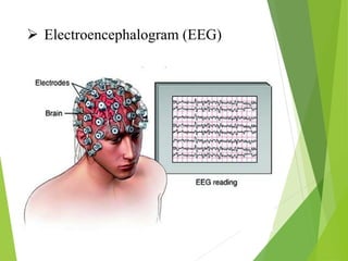  Electroencephalogram (EEG)
 