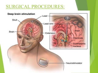 SURGICAL PROCEDURES:
 