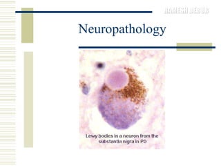Neuropathology 