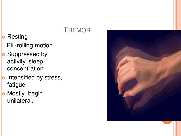 Parkinson’s disease