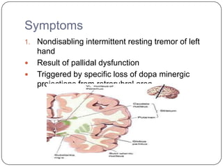 Symptoms
1. Nondisabling intermittent resting tremor of left
hand
 Result of pallidal dysfunction
 Triggered by specific loss of dopa minergic
projections from retrorubral area
 