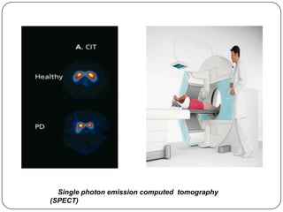 Single photon emission computed tomography
(SPECT)
 