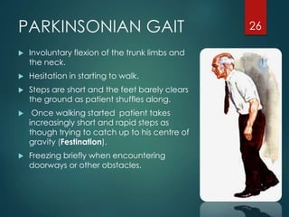 Festinating Parkinson’s disease | PPTX