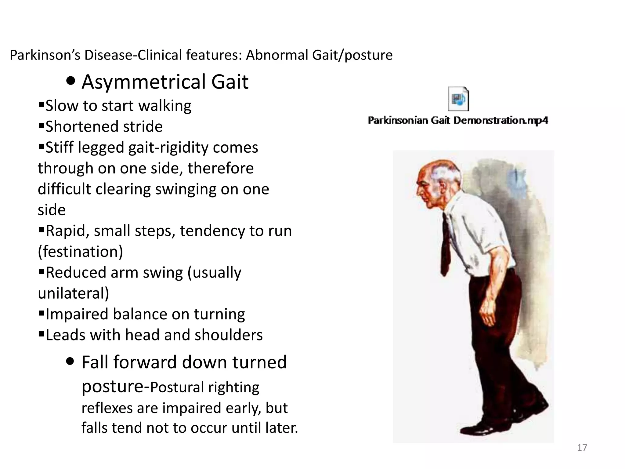 Festinating Parkinson's disease | PPTX