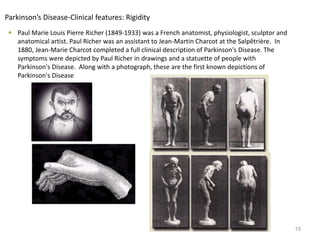  Paul Marie Louis Pierre Richer (1849-1933) was a French anatomist, physiologist, sculptor and
anatomical artist. Paul Richer was an assistant to Jean-Martin Charcot at the Salpêtrière. In
1880, Jean-Marie Charcot completed a full clinical description of Parkinson's Disease. The
symptoms were depicted by Paul Richer in drawings and a statuette of people with
Parkinson's Disease. Along with a photograph, these are the first known depictions of
Parkinson's Disease
15
Parkinson’s Disease-Clinical features: Rigidity
 