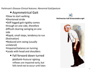  Asymmetrical Gait
Slow to start walking
Shortened stride
Stiff legged gait-rigidity comes
through on one side, therefore
difficult clearing swinging on one
side
Rapid, small steps, tendency to run
(festination)
Reduced arm swing (usually
unilateral)
Impaired balance on turning
Leads with head and shoulders
 Fall forward down turned
posture-Postural righting
reflexes are impaired early, but
falls tend not to occur until later.
17
Parkinson’s Disease-Clinical features: Abnormal Gait/posture
 