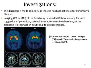 Investigations:
 The diagnosis is made clinically, as there is no diagnostic test for Parkinson's
disease.
 Imaging (CT or MRI) of the head may be needed if there are any features
suggestive of pyramidal, cerebellar or autonomic involvement, or the
diagnosis is otherwise in doubt (e.g to exclude stroke).
20
[18F]dopa PET and β-CIT SPECT images.
[18F]dopa PET uptake in the putamen
is reduced in PD.
 