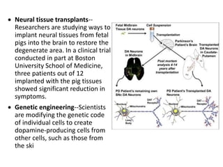  Neural tissue transplants--
Researchers are studying ways to
implant neural tissues from fetal
pigs into the brain to restore the
degenerate area. In a clinical trial
conducted in part at Boston
University School of Medicine,
three patients out of 12
implanted with the pig tissues
showed significant reduction in
symptoms.
 Genetic engineering--Scientists
are modifying the genetic code
of individual cells to create
dopamine-producing cells from
other cells, such as those from
the ski
 