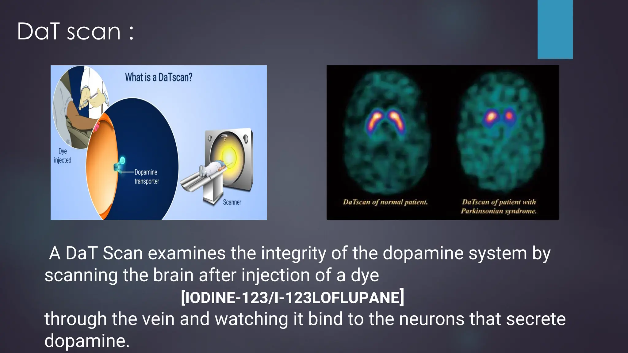 Parkinson S Disease Ppt Ppt