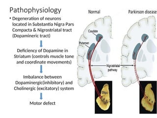 Pharmacotherapy of Parkinson’s Disease (3).ppt