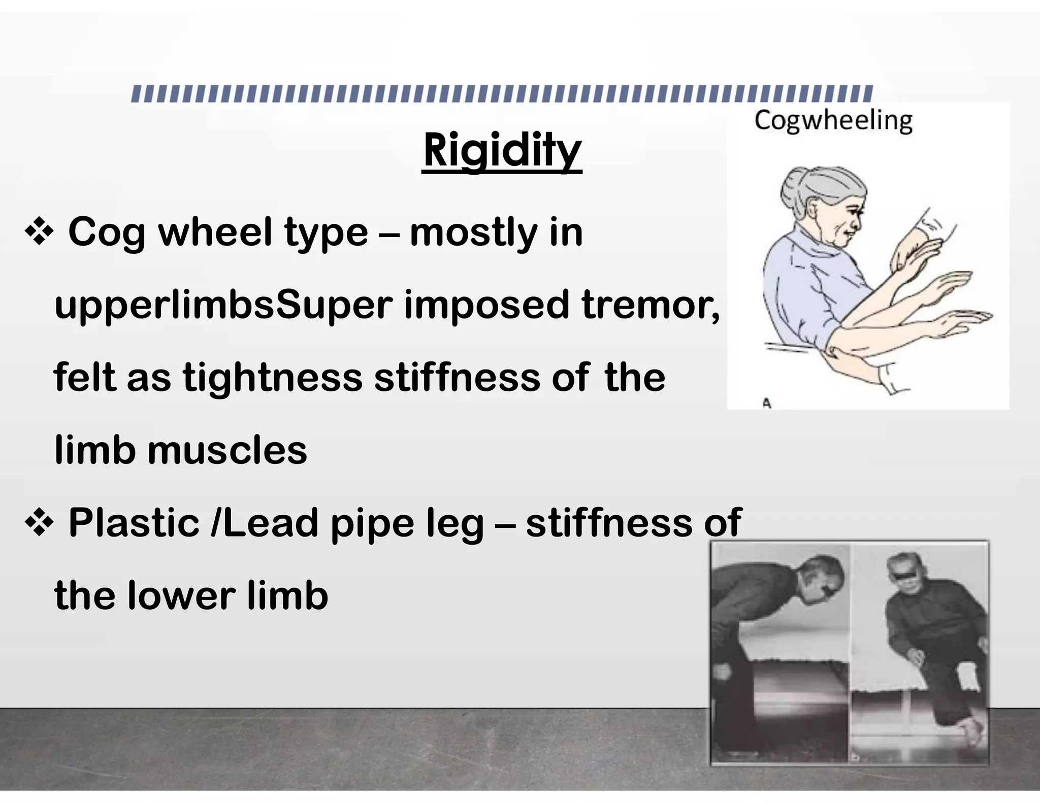 PARKINSON'S DISEASE PPT PDF.pdf