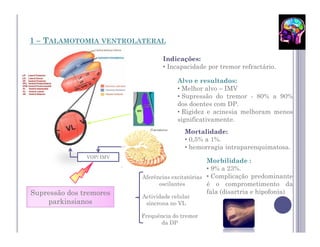 1 – TALAMOTOMIA     VENTROLATERAL

                                   Indicações:
                                   • Incapacidade por tremor refractário.

                                         Alvo e resultados:
                                         • Melhor alvo – IMV
                                         • Supressão do tremor - 80% a 90%
                                         dos doentes com DP.
                                         • Rigidez e acinesia melhoram menos
                                         significativamente.
                                            Mortalidade:
                                            • 0,5% a 1%.
                                            • hemorragia intraparenquimatosa.
               VOP/ IMV
                                                    Morbilidade :
                                                    • 9% a 23%.
                            Aferências excitatórias • Complicação predominante
                                  oscilantes        é o comprometimento da
Supressão dos tremores                              fala (disartria e hipofonia)
                            Actividade celular
    parkinsianos             síncrona no VL

                            Frequência do tremor
                                  da DP
 