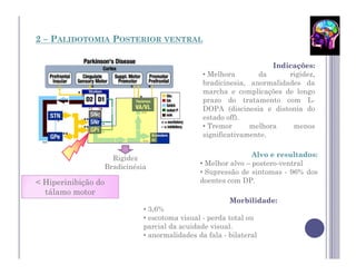2 – PALIDOTOMIA POSTERIOR VENTRAL

                                                                  Indicações:
                                              • Melhora       da      rigidez,
                                              bradicinesia, anormalidades da
                                              marcha e complicações de longo
                                              prazo do tratamento com L-
                                              DOPA (discinesia e distonia do
                                              estado off).
                                              • Tremor      melhora    menos
                                              significativamente.


                   Rigidez                                   Alvo e resultados:
                 Bradicinésia                • Melhor alvo – postero-ventral
                                             • Supressão de sintomas - 96% dos
< Hiperinibição do                           doentes com DP.
  tálamo motor
                                                      Morbilidade:
                            • 3,6%
                            • escotoma visual - perda total ou
                            parcial da acuidade visual.
                            • anormalidades da fala - bilateral
 