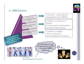 2 – DBS PALIDAL

                                      • acinesia – anula efeitos
                                      terapêuticos da L-DOPA.

                                      • melhora a acinesia e a
                                      rigidez
                                      • movimentos involuntários
                                      anormais (discinesias)
                                      • melhora a rigidez
                                      • leva a acinesia e
                                      anormalidades de marcha.



                            características mais
                           incapacitantes da DP
                              avançada NÃO
                                 melhoram



           Acinesia
           Anormalidades de marcha
 