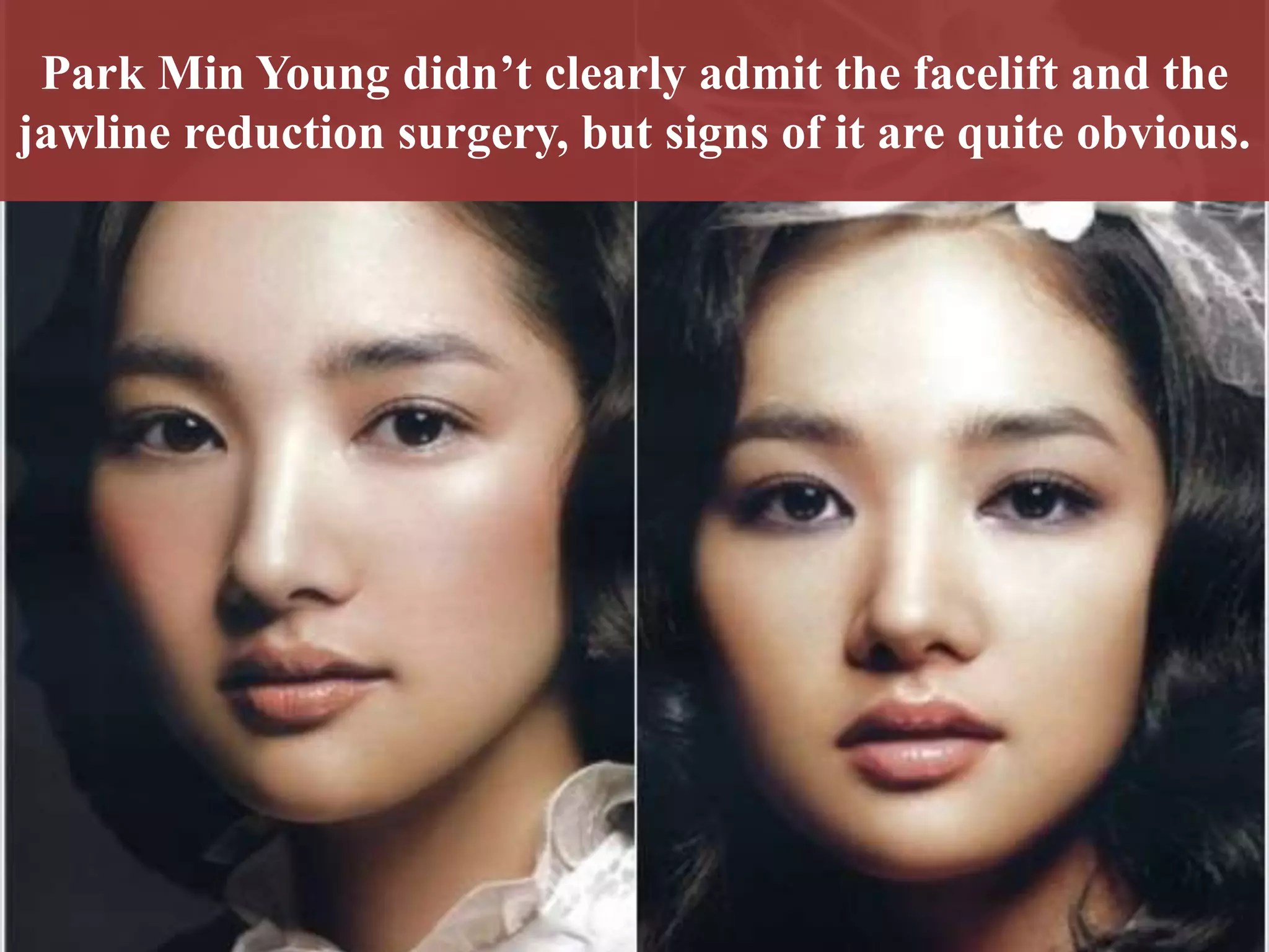 park min young plastic surgery Image 9