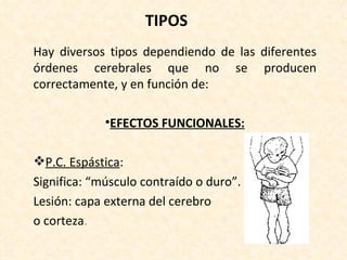 TIPOS Hay diversos tipos dependiendo de las diferentes órdenes cerebrales que no se producen correctamente, y en función de: EFECTOS FUNCIONALES: P.C. Espástica : Significa: “músculo contraído o duro”. Lesión: capa externa del cerebro o corteza . 