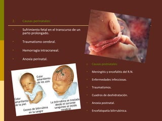 2. Causas perinatales:
• Sufrimiento fetal en el transcurso de un
parto prolongado.
• Traumatismo cerebral.
• Hemorragia intracraneal.
• Anoxia perinatal.
3. Causas postnatales:
• Meningitis y encefalitis del R.N.
• Enfermedades infecciosas.
• Traumatismos.
• Cuadros de deshidratación.
• Anoxia postnatal.
• Encefalopatía bilirrubínica.
 