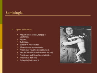 Semiología
• Signos y Síntomas:
 Movimientos lentos, torpes o
vacilantes.
 Rigidez.
 Debilidad.
 Espasmos musculares.
 Movimientos involuntarios.
 Problemas visuales (estrabismos).
 Percepción visual (calcular distancias).
 Problemas auditivos (p.c. atetoide).
 Problemas de habla
 Epilepsia (1 de cada 3)
 