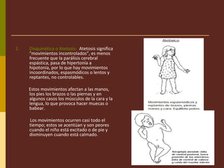 2. Disquinética o Atetosis: Atetosis significa
"movimientos incontrolados”, es menos
frecuente que la parálisis cerebral
espástica, pasa de hipertonía a
hipotonía, por lo que hay movimientos
incoordinados, espasmódicos o lentos y
reptantes, no controlables.
Estos movimientos afectan a las manos,
los pies los brazos o las piernas y en
algunos casos los músculos de la cara y la
lengua, lo que provoca hacer muecas o
babear.
Los movimientos ocurren casi todo el
tiempo; estos se acentúan y son peores
cuando el niño está excitado o de pie y
disminuyen cuando está calmado.
 