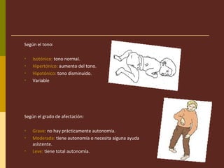 Según el tono:
• Isotónico: tono normal.
• Hipertónico: aumento del tono.
• Hipotónico: tono disminuido.
• Variable
Según el grado de afectación:
• Grave: no hay prácticamente autonomía.
• Moderada: tiene autonomía o necesita alguna ayuda
asistente.
• Leve: tiene total autonomía.
 