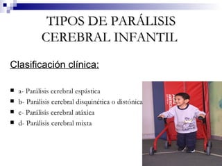 TIPOS DE PARÁLISIS CEREBRAL INFANTIL   Clasificación clínica: a- Parálisis cerebral espástica b- Parálisis cerebral disquinética o distónica  c- Parálisis cerebral atáxica d- Parálisis cerebral mixta 