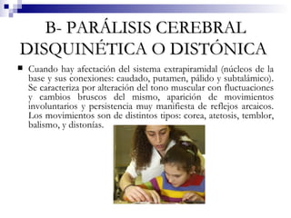 B- PARÁLISIS CEREBRAL DISQUINÉTICA O DISTÓNICA   Cuando hay afectación del sistema extrapiramidal (núcleos de la base y sus conexiones: caudado, putamen, pálido y subtalámico). Se caracteriza por alteración del tono muscular con fluctuaciones y cambios bruscos del mismo, aparición de movimientos involuntarios y persistencia muy manifiesta de reflejos arcaicos. Los movimientos son de distintos tipos: corea, atetosis, temblor, balismo, y distonías.  