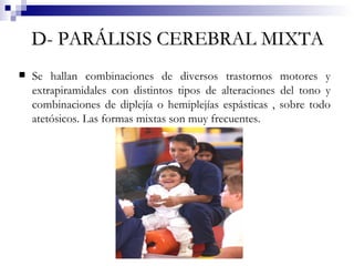 D- PARÁLISIS   CEREBRAL MIXTA Se hallan combinaciones de diversos trastornos motores y extrapiramidales con distintos tipos de alteraciones del tono y combinaciones de diplejía o hemiplejías espásticas , sobre todo atetósicos. Las formas mixtas son muy frecuentes.  