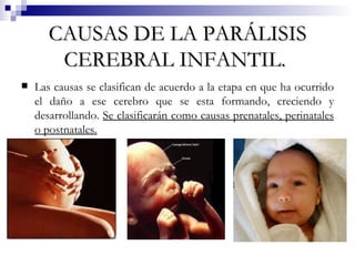 CAUSAS DE LA PARÁLISIS CEREBRAL INFANTIL.   Las causas se clasifican de acuerdo a la etapa en que ha ocurrido el daño a ese cerebro que se esta formando, creciendo y desarrollando.  Se clasificarán como causas prenatales, perinatales o postnatales.   