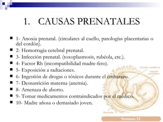 CAUSAS PRENATALES 1- Anoxia prenatal. (circulares al cuello, patologías placentarias o del cordón). 2- Hemorragia cerebral prenatal. 3- Infección prenatal. (toxoplasmosis, rubéola, etc.). 4- Factor Rh (incompatibilidad madre-feto). 5- Exposición a radiaciones. 6- Ingestión de drogas o tóxicos durante el embarazo. 7- Desnutrición materna (anemia). 8- Amenaza de aborto. 9- Tomar medicamentos contraindicados por el médico. 10- Madre añosa o demasiado joven. 