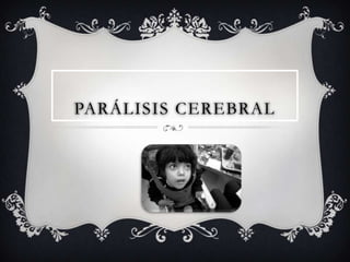 PARÁLISIS CEREBRAL 